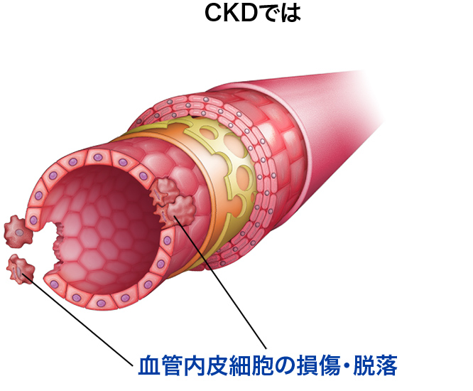 CKDでは