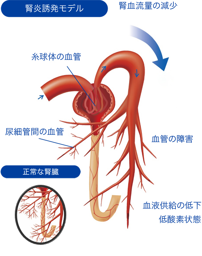 腎炎誘発モデル